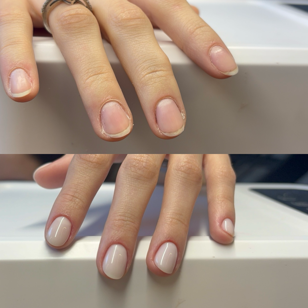 Comparação real de unhas antes e depois: acima naturais e sem acabamento, abaixo com blindagem e esmaltação em gel nude